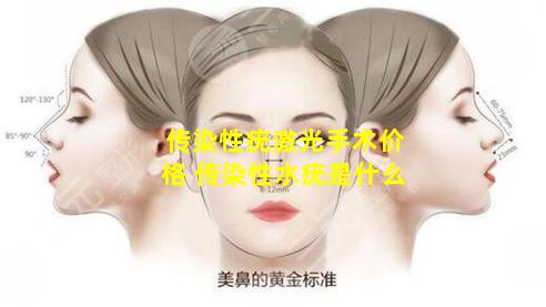传染性疣激光手术价格 传染性水疣是什么